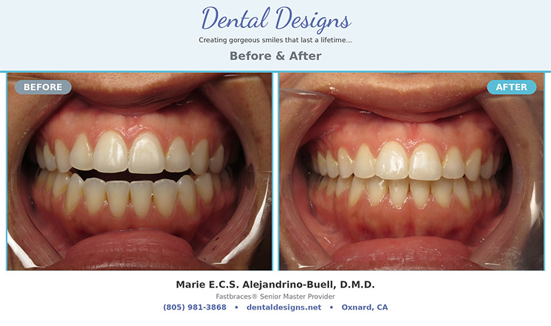 Dental treatment before and after results