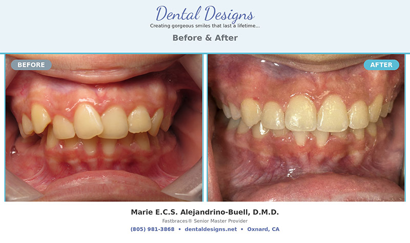 Dental treatment before and after results