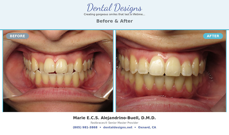 Dental treatment before and after results