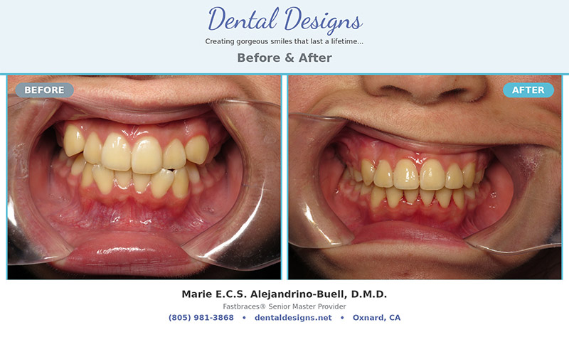 Dental treatment before and after results
