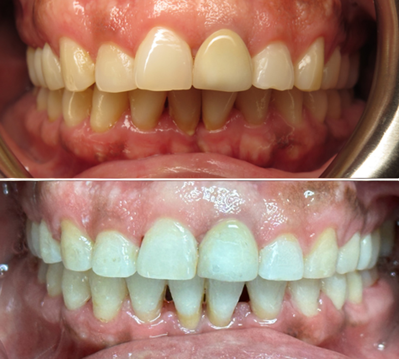 before and after