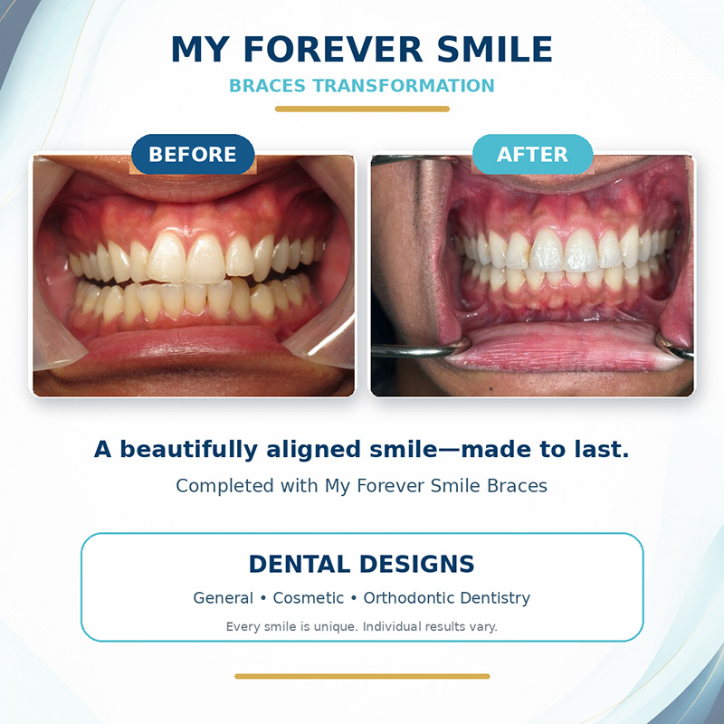 before and after
