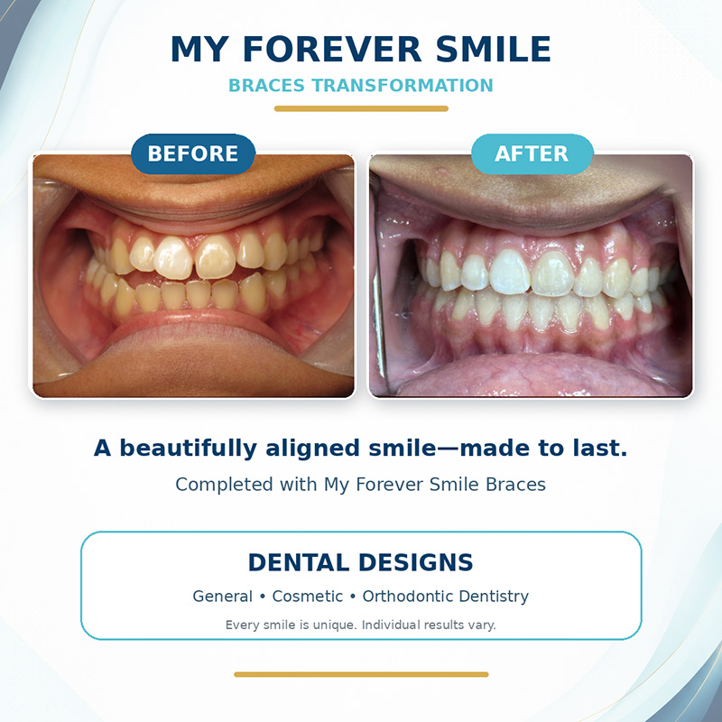 before and after